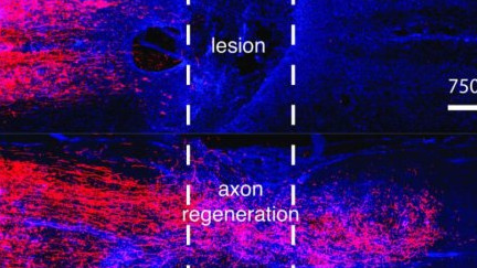 Ученые нашли способ восстановления нервных волокон