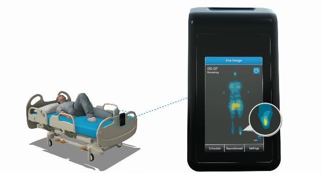 Система MAP постоянно отслеживает пациентов на пролежни